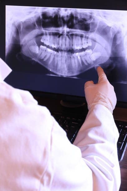 Best Emergency Wisdom Tooth Extraction in Tarrant, AL